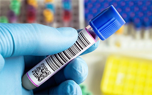 脂蛋白相關(guān)磷脂酶A2（Lp-PLA2）檢測原理及相關(guān)原料