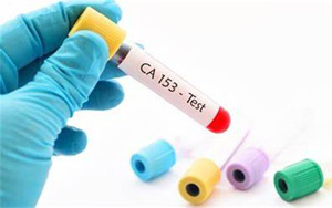 糖類(lèi)抗原15-3(CA15-3)-磁微?；瘜W(xué)發(fā)光法（AE/AP）解決方案