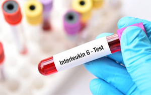 白介素-6（IL-6）-磁微?；瘜W發(fā)光（吖啶酯） /熒光免疫層析解決方案