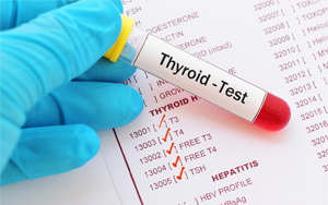 促甲狀腺素（TSH）-磁微?；瘜W(xué)發(fā)光法（吖啶酯） /熒光免疫層析解決方案