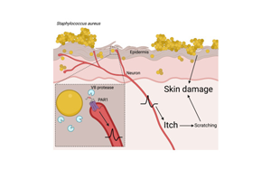 Cell：首次證明一種常見的皮膚細(xì)菌可以通過直接作用于神經(jīng)細(xì)胞而引起瘙癢