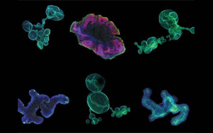 再生醫(yī)學(xué)的未來(lái)，到類器官的世界中去