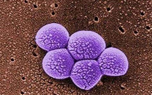 《Science》突破性新抗生素，遏制耐藥細菌