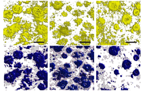 Nature：光和聲可以清除阿爾茨海默氏癥小鼠的淀粉樣蛋白！