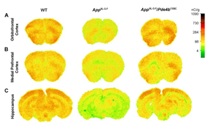 發(fā)現(xiàn)阿爾茨海默病的新治療靶點(diǎn)PDE4B 活性降低27%可大大挽救AD小鼠記憶、大腦功能和炎癥