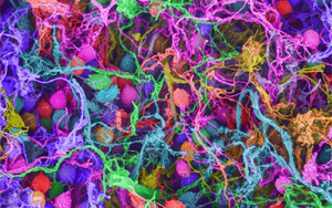 Nature：要想形成長(zhǎng)期記憶，必須有DNA損傷和腦部炎癥？！