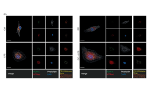 《Nature》第一次揭開糖皮質(zhì)激素如何激活人體對(duì)炎癥的自然“剎車”