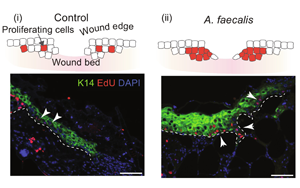 Science子刊揭示了一種細(xì)菌如何幫助慢性糖尿病傷口愈合
